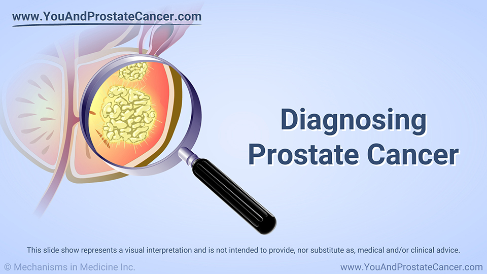 Diagnosing Prostate Cancer