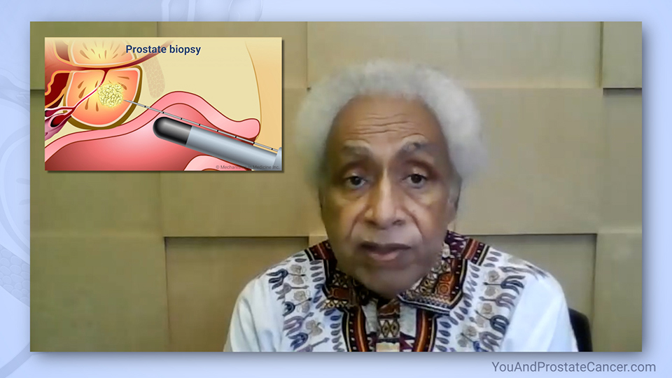 What is a prostate cancer biopsy? What does it tell?