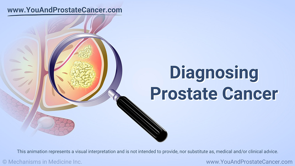 Diagnosing Prostate Cancer