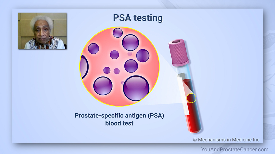 How is prostate cancer diagnosed? What is a DRE? What is a PSA?