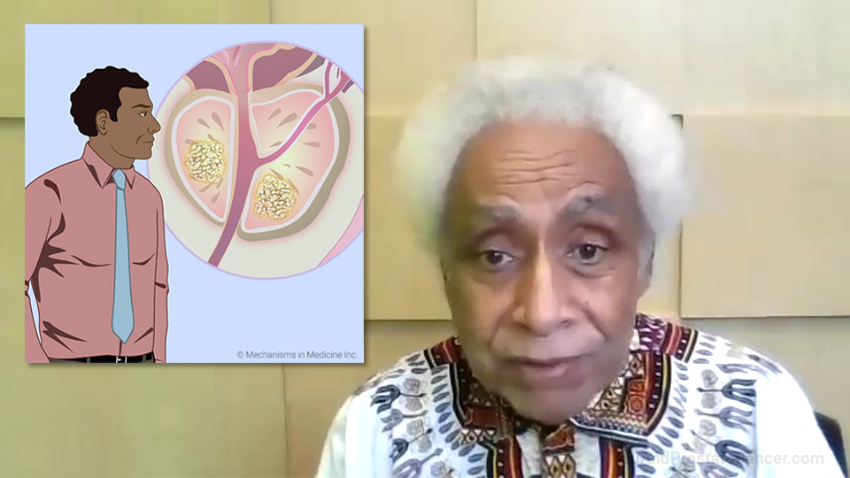 Prostate Cancer in Black American Men