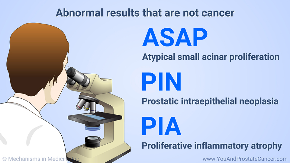 Abnormal results that are not cancer