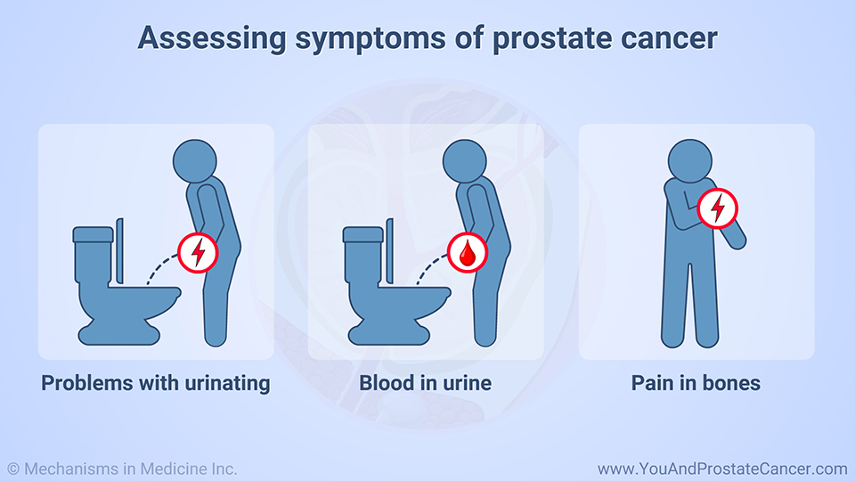 Assessing symptoms of prostate cancer
