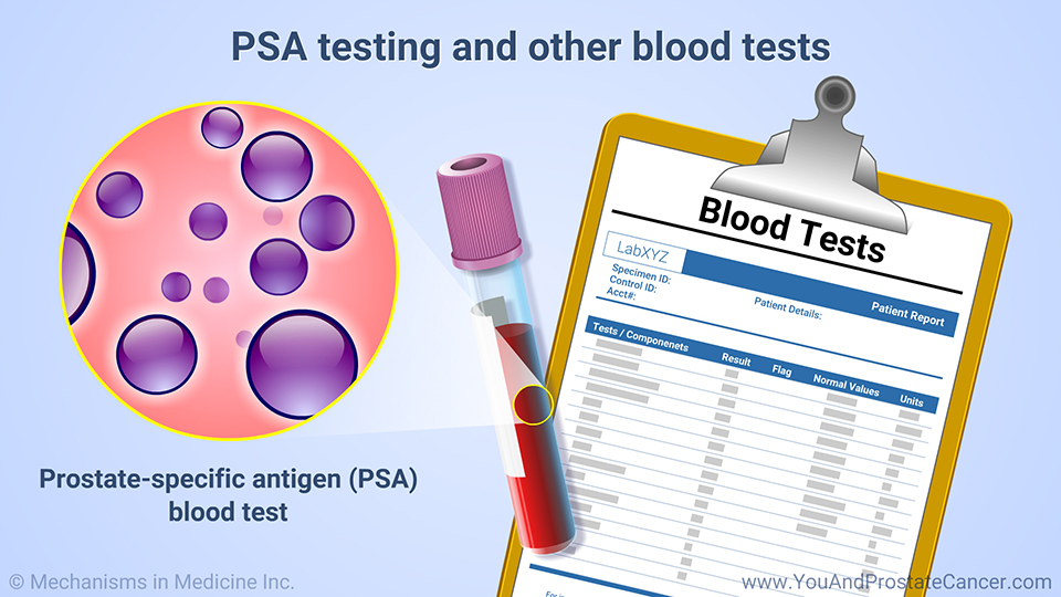 PSA testing and other blood tests