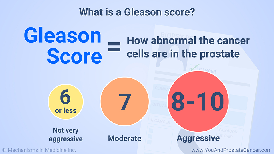 What is a Gleason score?