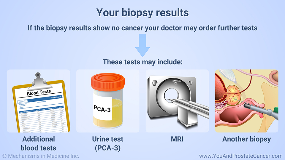 Your biopsy results