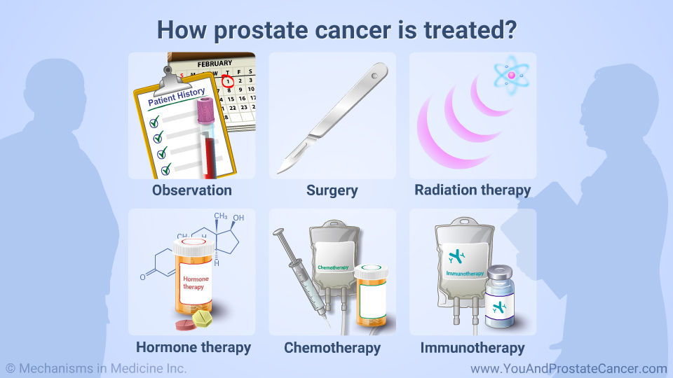 How prostate cancer is treated?